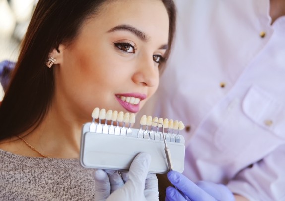 Woman's smile compared with porcelain veneer shade chart