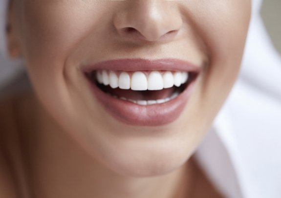 Closeup of bright smile after teeth whitening