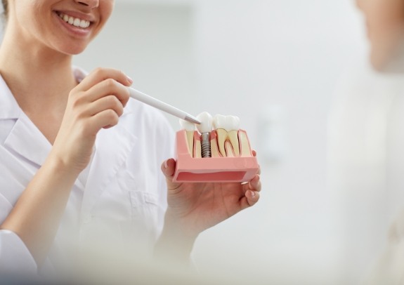 Dentist and patient discussing the cost of dental implants